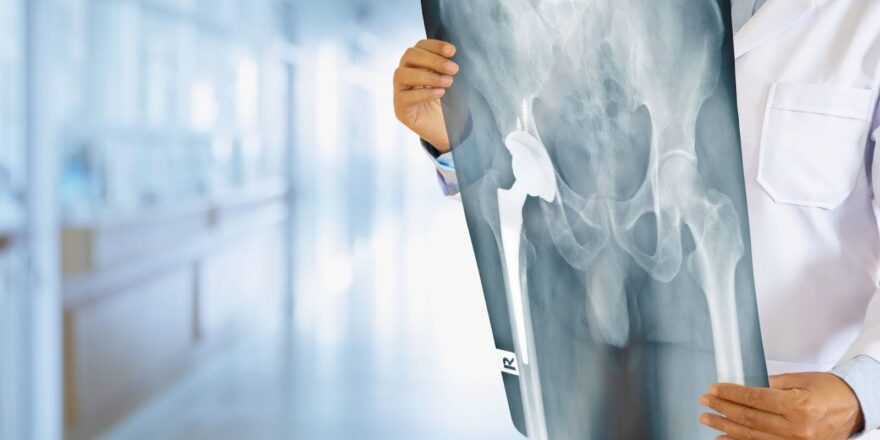 Hip Replacement Surgery in Abu Dhabi