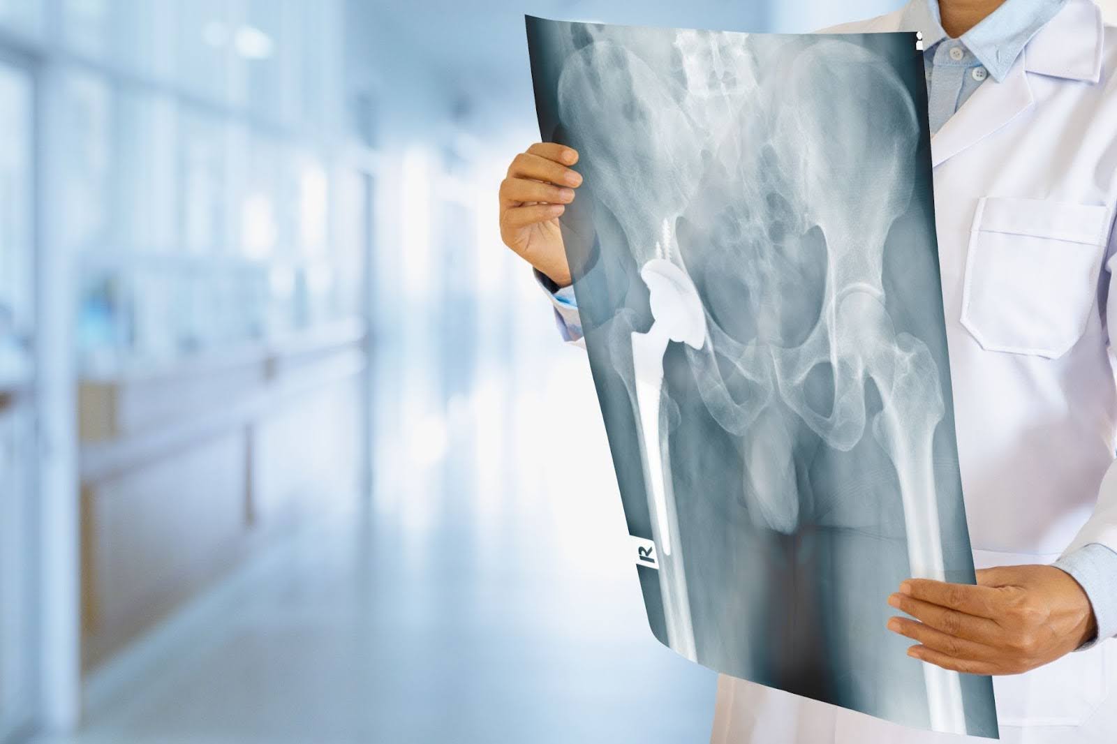 Hip Replacement Surgery in Abu Dhabi