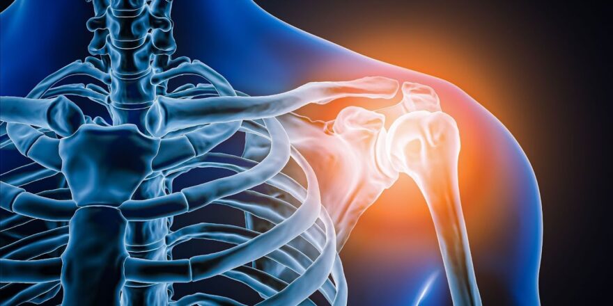 10 Remedies for Quick Relief from Shoulder Pain