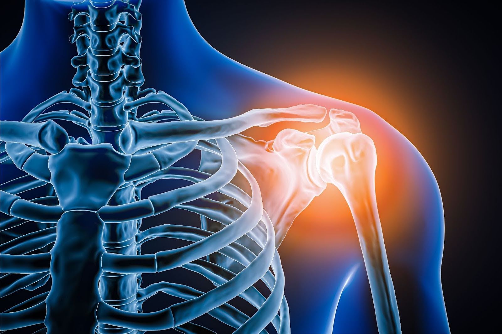 10 Remedies for Quick Relief from Shoulder Pain