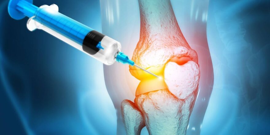 Biologic Injections (PRP, Stem Cells) for Joint Preservation Evidence vs Hype